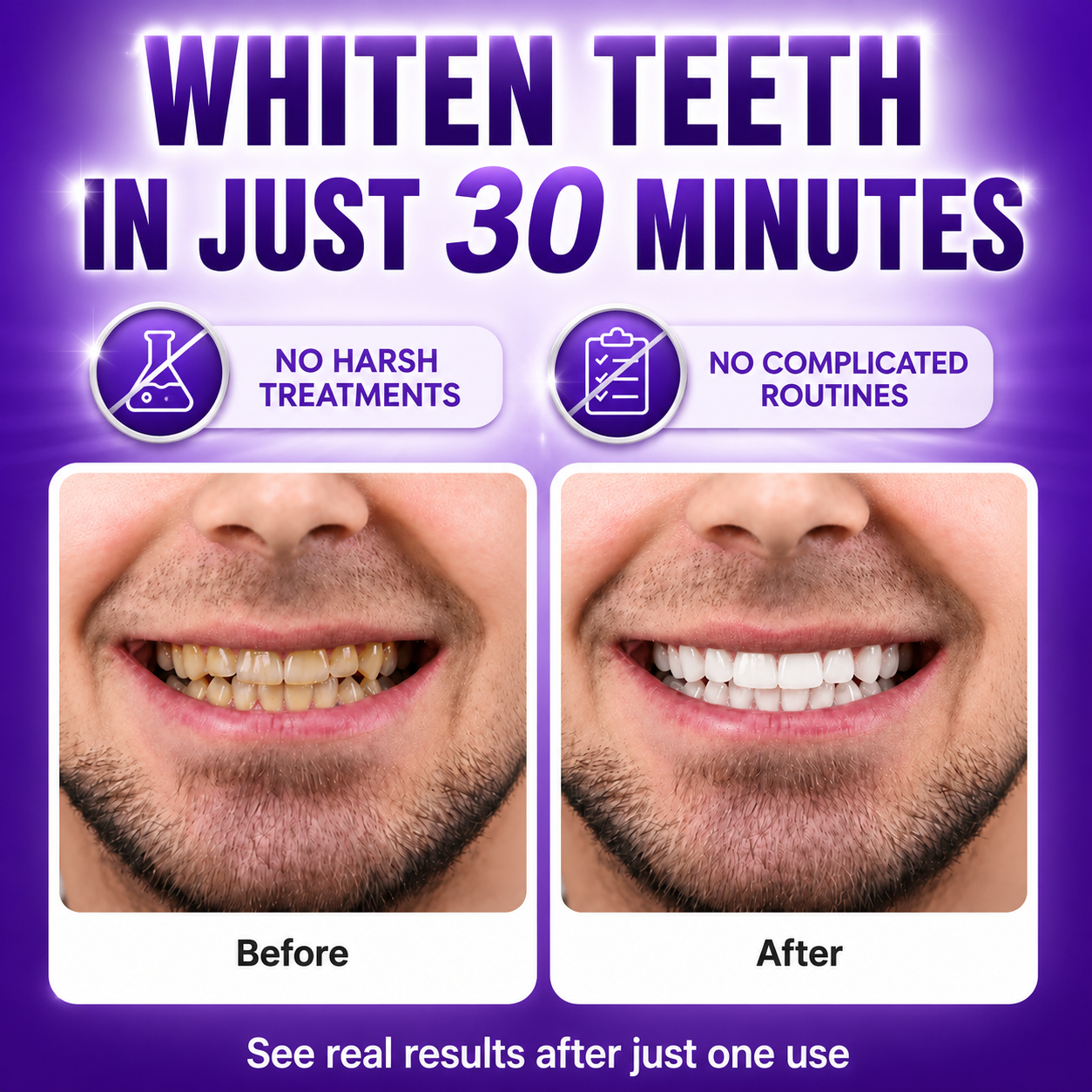 💥LAST DAY SALE 70% OFF💥 VioSmile™ Purple Teeth Whitening Strips for Stain Removal & Sensitivity