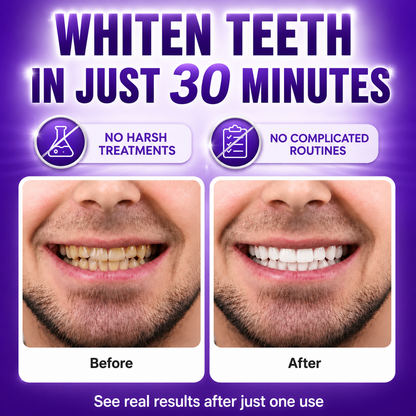 💥LAST DAY SALE 70% OFF💥 VioSmile™ Purple Teeth Whitening Strips for Stain Removal & Sensitivity
